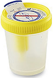 kontejner-vacutest-dlya-sbora-mochi-koshek-i-sobak-sterilnyj.jpg kontejner-vacutest-dlya-sbora-mochi-koshek-i-sobak-sterilnyj.jpg