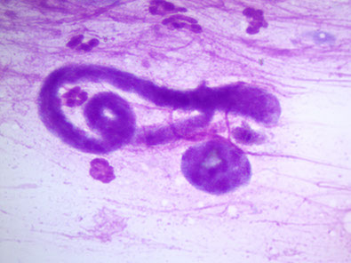 lechenie-dirofilyarioza-sobak-mikrofilyarii-dirofilaria-immitis-ieu7583-fr.png